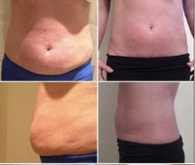 Load image into Gallery viewer, Aqualyx Fat Dissolve