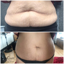 Load image into Gallery viewer, Aqualyx Fat Dissolve